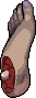 Sassy's Dislocated Foot